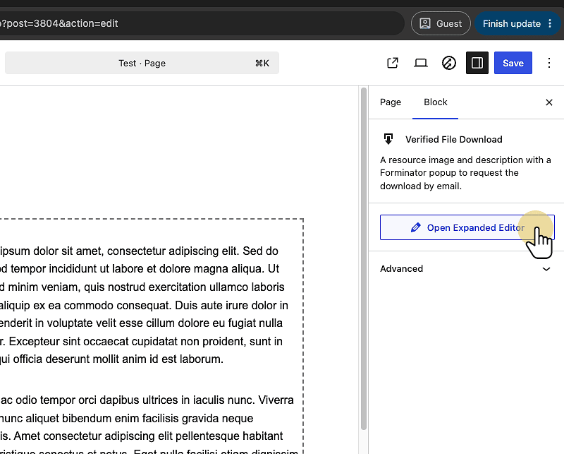 Click "Open Expanded Editor"